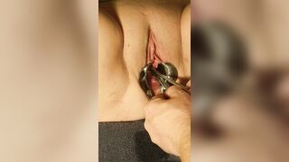 BDSM Medical Pussy Play Torture Female Urethral Peehole Stretching Leaking Pee - 10 image