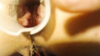 Anal speculum and show inside my asshole - 11 image