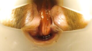 Anal speculum and show inside my asshole - 12 image