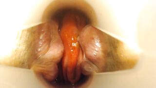 Anal speculum and show inside my asshole - 13 image