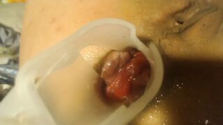 Anal speculum and show inside my ass part 2 - 1 image