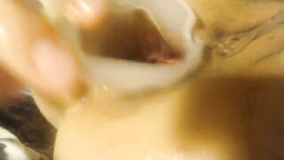 Anal speculum and show inside my ass part 2 - 10 image