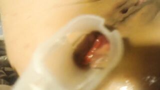 Anal speculum and show inside my ass part 2 - 11 image
