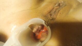 Anal speculum and show inside my ass part 2 - 12 image
