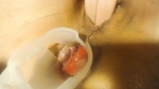 Anal speculum and show inside my ass part 2 - 13 image