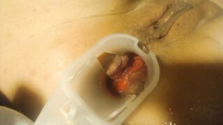 Anal speculum and show inside my ass part 2 - 14 image