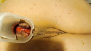 Anal speculum and show inside my ass part 2