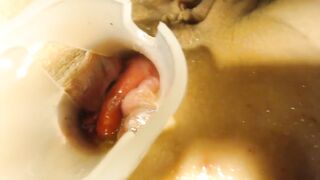 Anal speculum and show inside my ass part 2 - 8 image