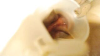 Anal speculum and show inside my ass part 2 - 9 image