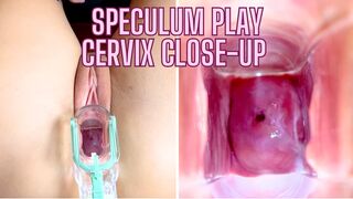 Stella St. Rose - Speculum Play, See My Cervix Close Up - 1 image