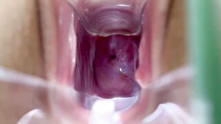 Stella St. Rose - Speculum Play, See My Cervix Close Up - 13 image