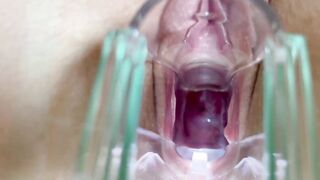 Stella St. Rose - Speculum Play, See My Cervix Close Up - 14 image