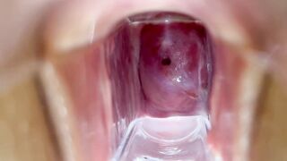 Stella St. Rose - Speculum Play, See My Cervix Close Up