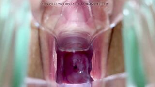 Stella St. Rose - Speculum Play, See My Cervix Close Up - 9 image